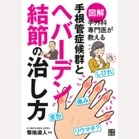図解手外科専門医が教える手根管症候群とへバーデン結節の治し方