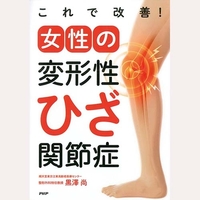 これで改善女性の変形性ひざ関節症