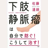 下肢静脈瘤は自分で防ぐこうして治す